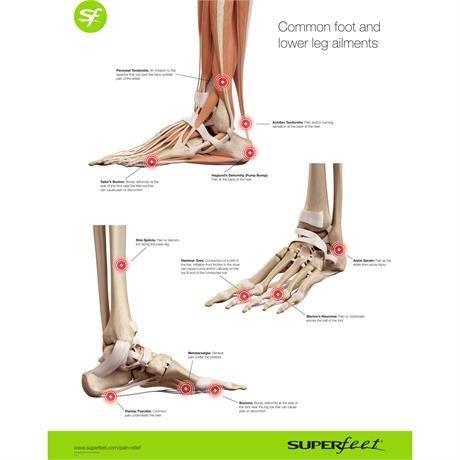 Trail Blazer Comfort Insole - Image 6